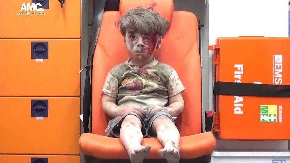 Un niño con el rostro y el cuerpo ensangrentados