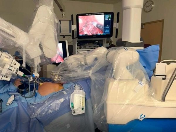 Sistema robótico MARS en acción durante una cirugía pionera.