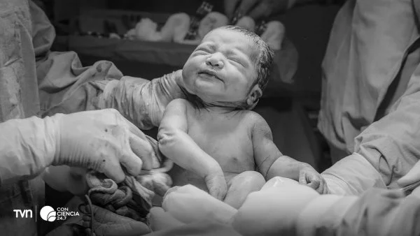 Bebé recién nacido con partículas de microplásticos en la placenta.