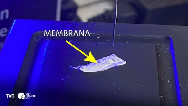 Primer plano de una membrana biocompatible sobre una úlcera en proceso de cicatrización, destacando su textura innovadora.