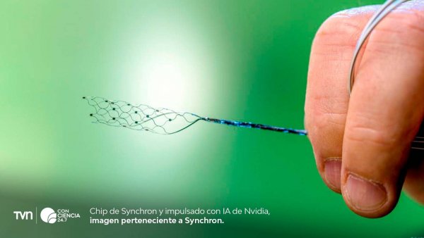 Chip de Synchron y Nvidia.