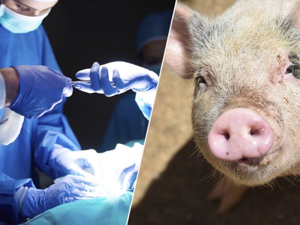 Trasplante de hígado de cerdo a ser humano.