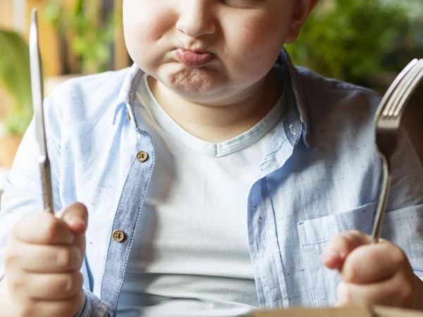 Mapa Nutricional 2024. Niño con obesidad/sobrepeso