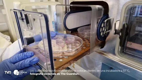 Técnico analiza tejido cerebral humano vivo bajo microscopio en laboratorio de neurociencia.