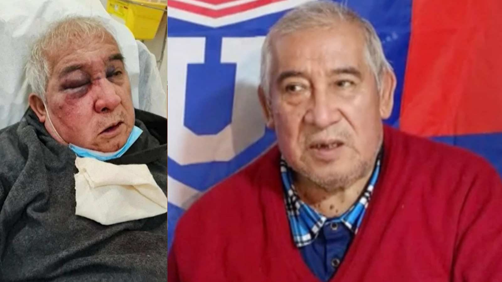 Conserje agredido