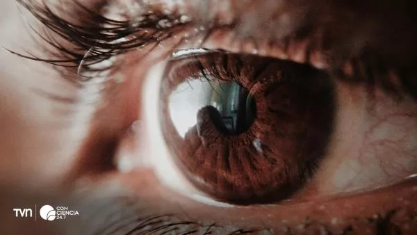 Foto de ojo referencial de un lente de contacto.