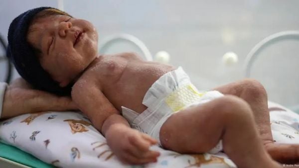 Bebés hiperrealistas