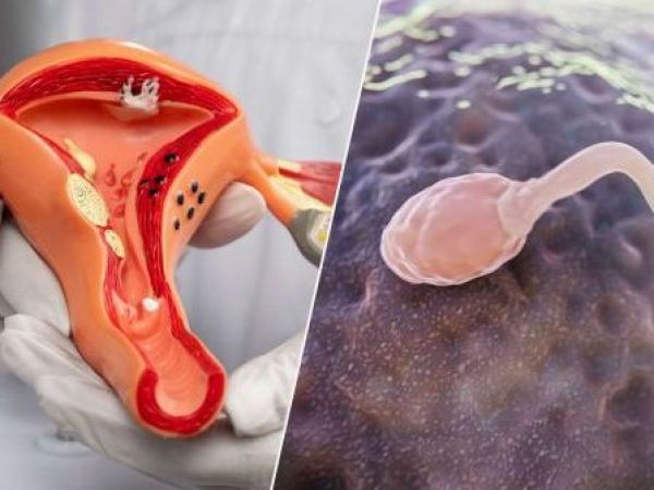 Representación de ovarios y un espermatozoide