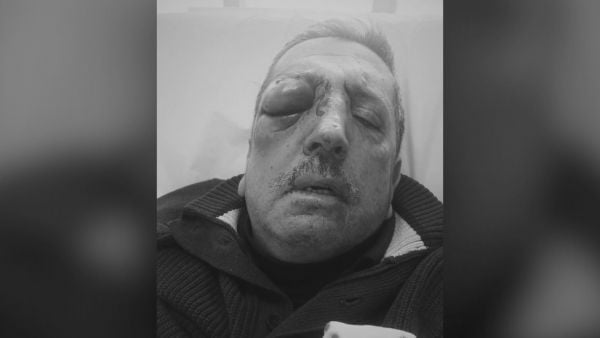 chofer de micro agredido en Villa Alemana.