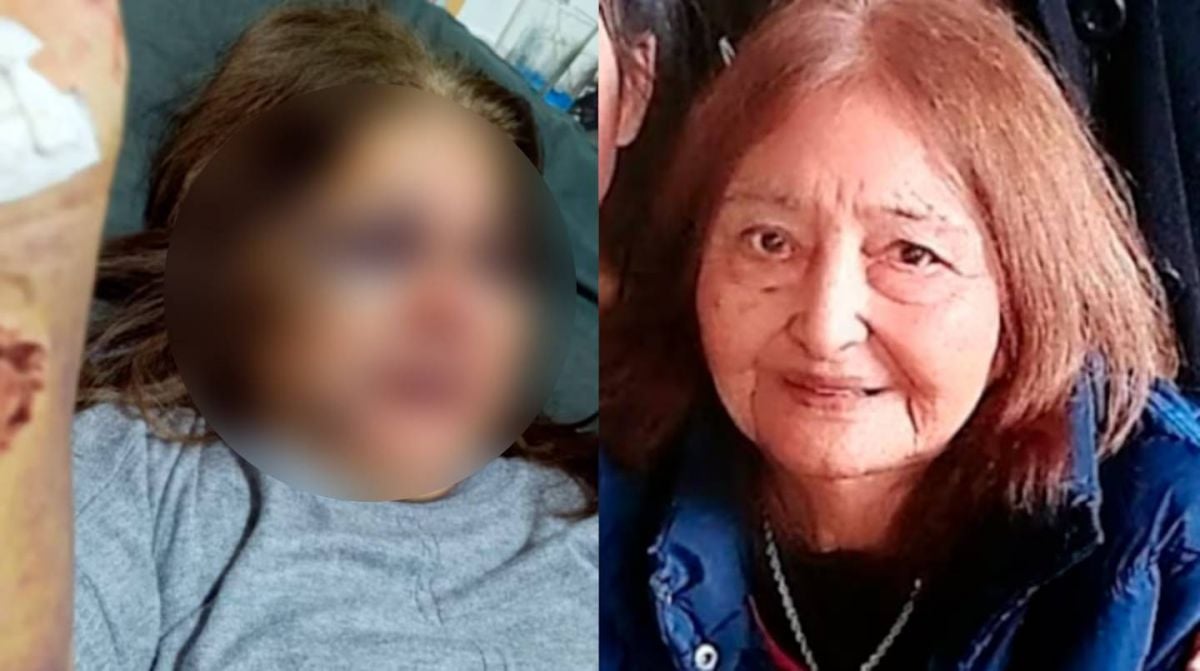 El escalofriante relato de mujer que sobrevivió a agresión de su esposo luego que su madre la defendiera