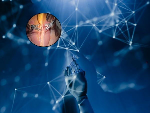 Mano de un robot y al costado la operación real de la extirpación de vesícula biliar