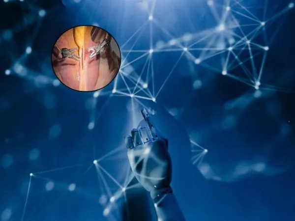 Mano de un robot y al costado la operación real de la extirpación de vesícula biliar