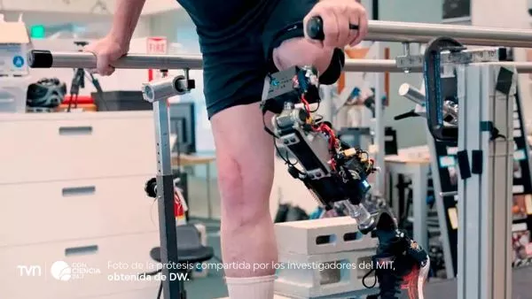 Rodilla biónica desarrollada por el MIT, integrada al hueso y músculos para restaurar movimiento natural.