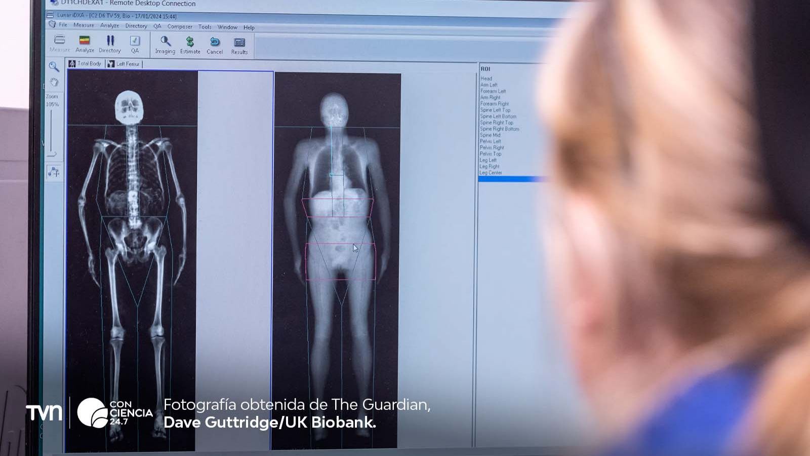 Escaneo 3D de 100 mil personas podría revolucionar diagnóstico médico realizado por UK Biobank.