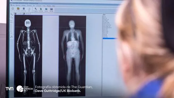 Escaneo 3D de 100 mil personas podría revolucionar diagnóstico médico realizado por UK Biobank.
