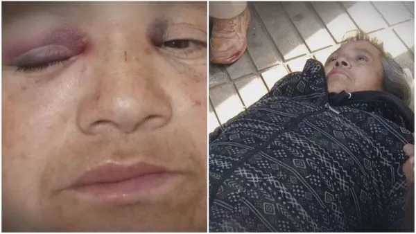 Ximena Riveros lesiones.