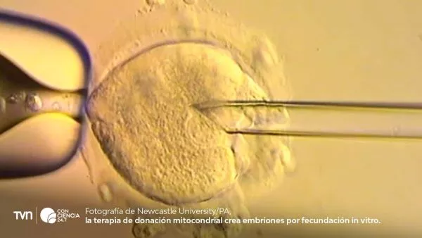 Equipo médico del Reino Unido responsable de la técnica de ADN de tres personas que permitió el nacimiento de ocho bebés sanos.