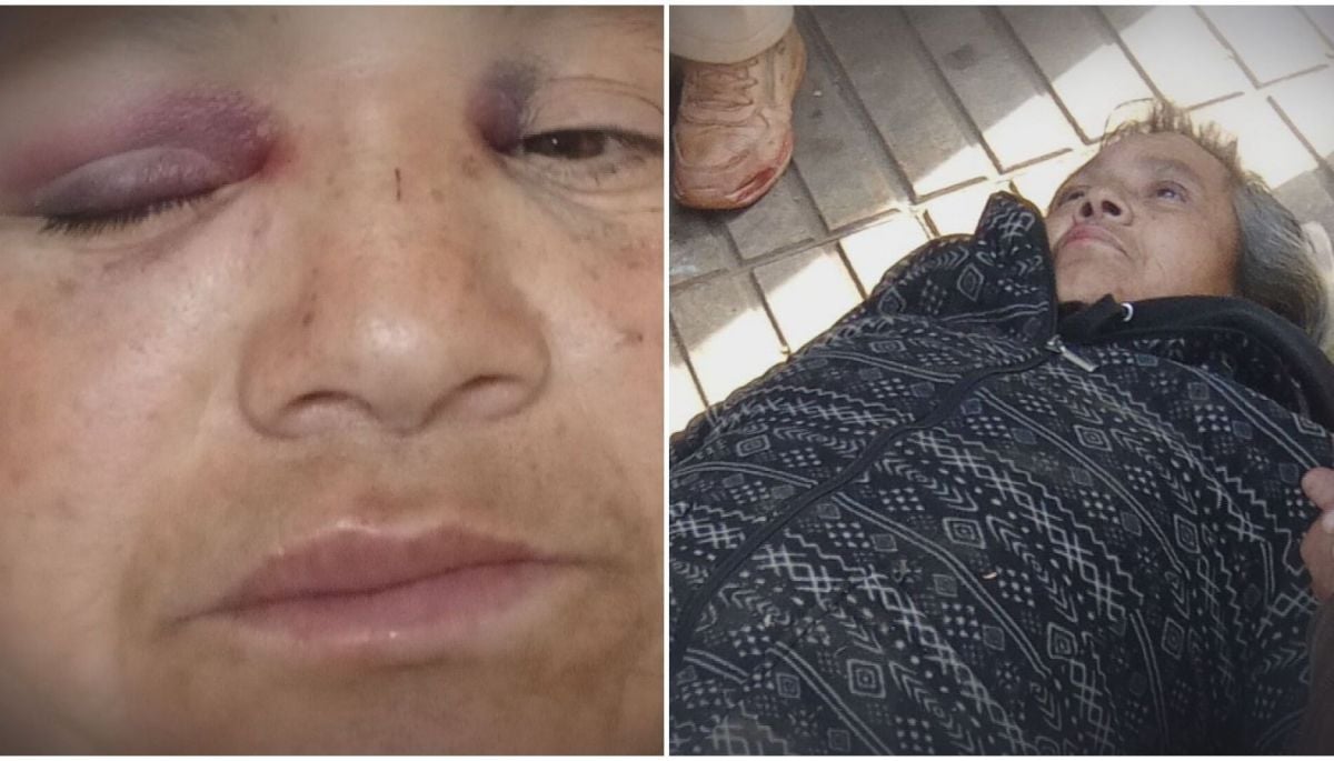 Puerta de micro se desprendió y golpeó a cantante urbana en Valparaíso: 