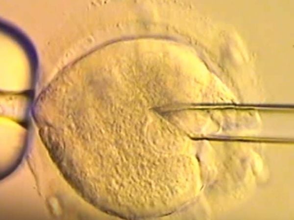 Equipo médico del Reino Unido responsable de la técnica de ADN de tres personas que permitió el nacimiento de ocho bebés sanos.