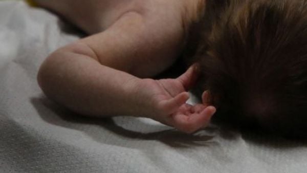 Bebé fue drogado y quemado