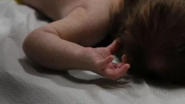 Bebé fue drogado y quemado