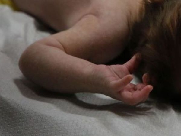 Bebé fue drogado y quemado