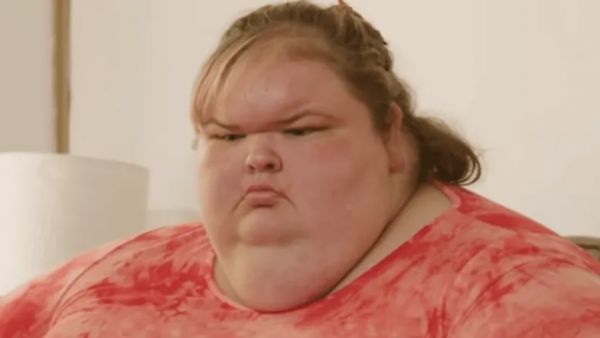 Cirugías Tammy Slaton