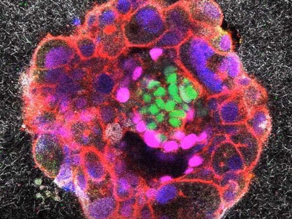 Imagen microscópica que muestra la implantación de un embrión humano en un tejido que simula el revestimiento uterino.