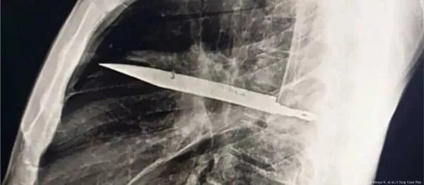 CUCHILLO EN EL TORAX