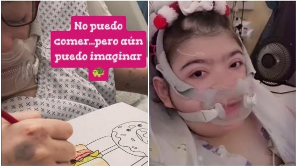 Joven chilena no puede comer y sueña con dibujar comida