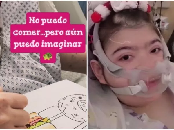 Joven chilena no puede comer y sueña con dibujar comida