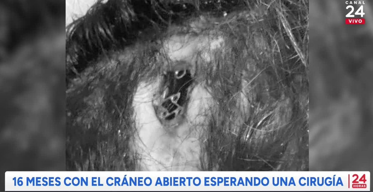 24 Horas