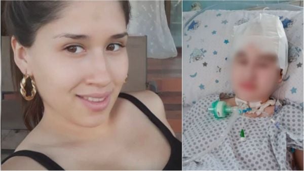 La historia de Bianca: lleva 16 años con el cráneo abierto esperando operación