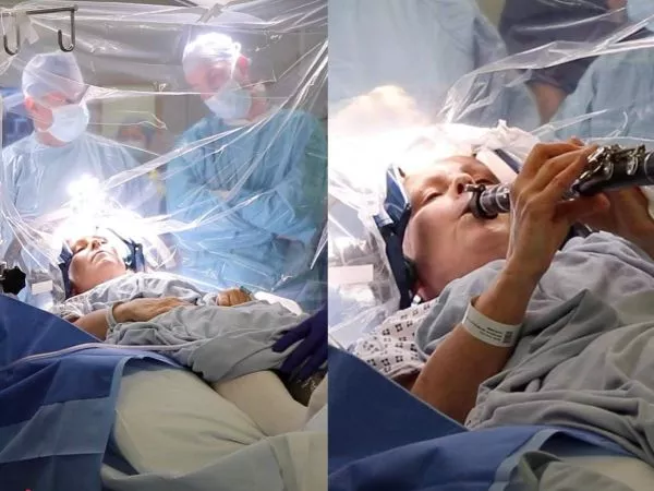 Mujer con Parkinson toca el clarinete mientras la operan