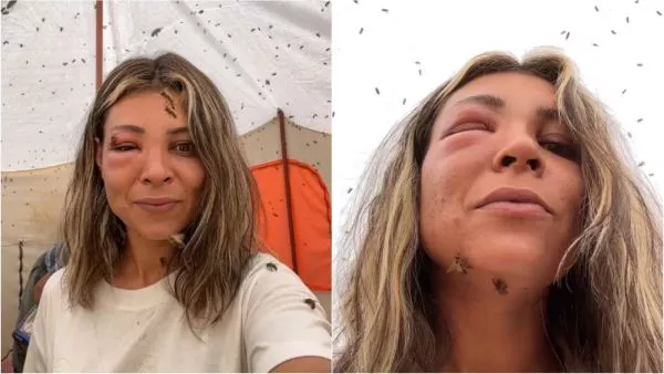 Mujer se hace picar por miles de abejas 