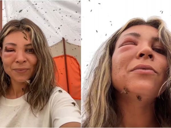 Mujer se hace picar por miles de abejas
