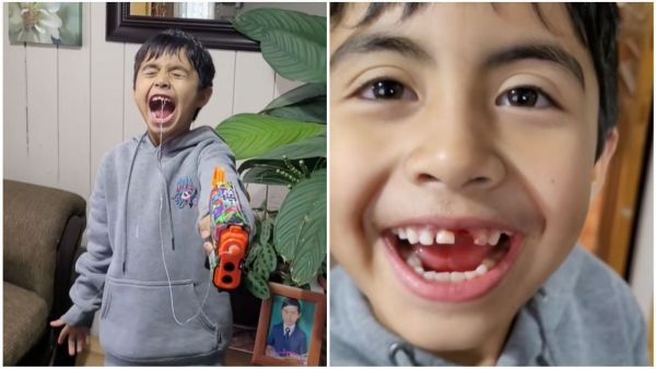 Niño de 8 años se sacó un diente
