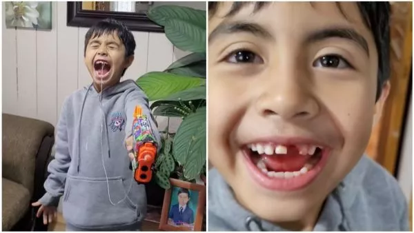 Niño de 8 años se sacó un diente
