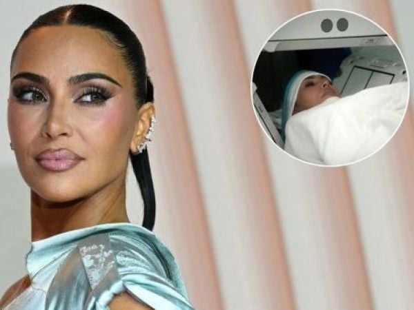 Kim Kardashian y su aneurisma cerebral
