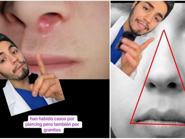 Dermatólogo explica triángulo de la muerte