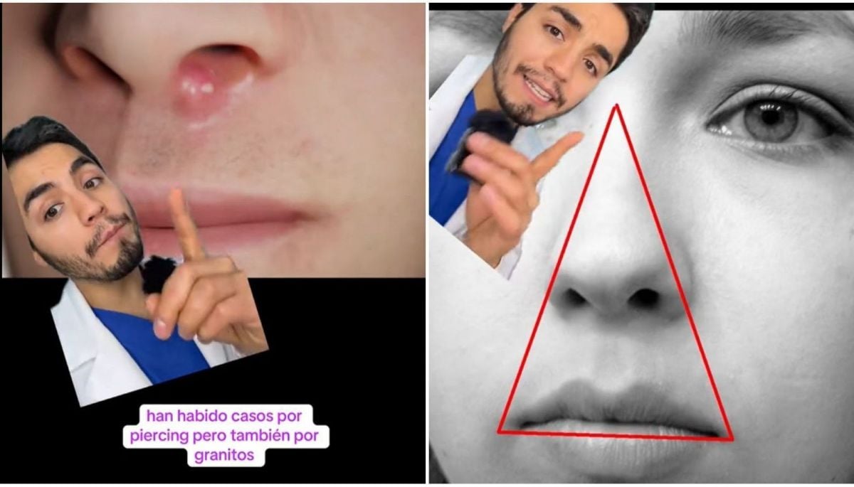 ✨ #Tendencias   
Dermatólogo explica qué pasa si te revientas un grano en el "triángulo de la muerte"
   
Más detalles ⬇