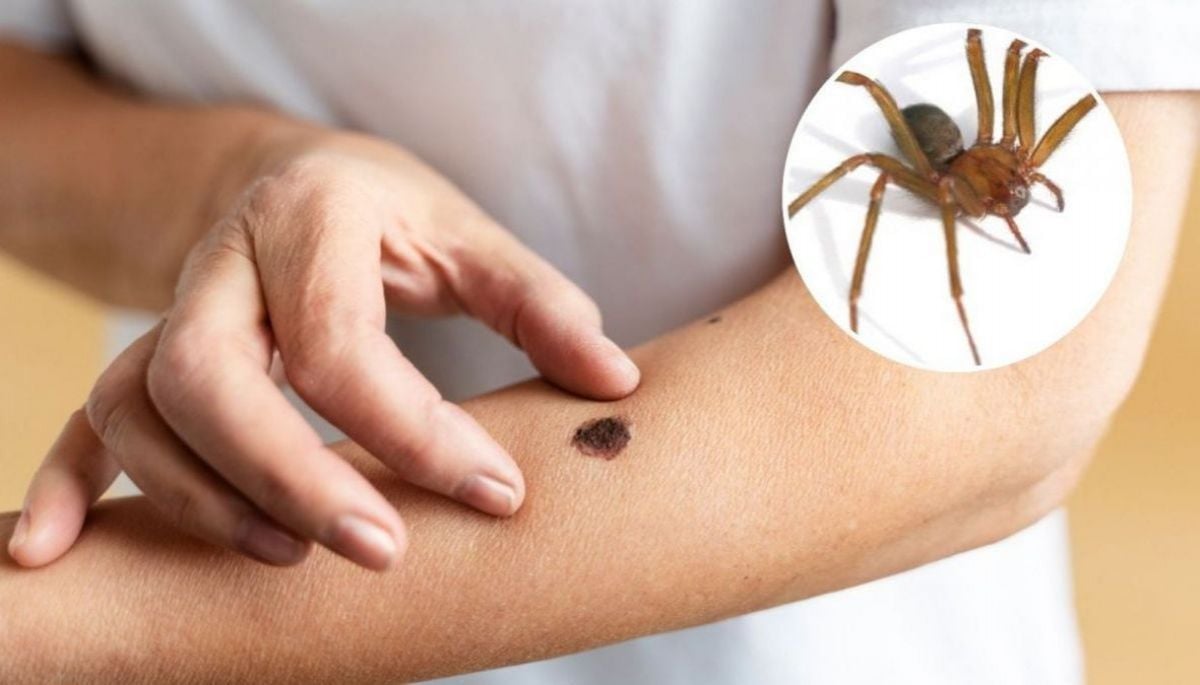 ✨ #Tendencias 

Araña de rincón: ¿Qué hacer frente a una picadura y cuándo acudir a urgencias?