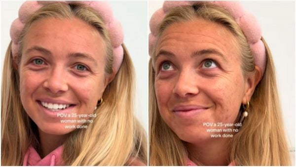 Tiktoker mostró su piel a los 25 años y desató ola de comentarios