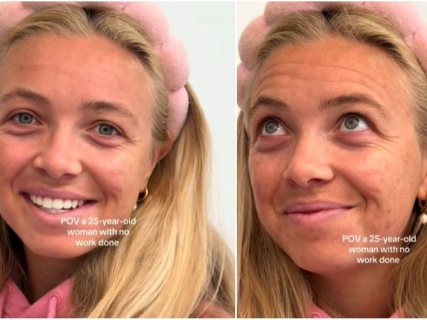 Tiktoker mostró su piel a los 25 años y desató ola de comentarios