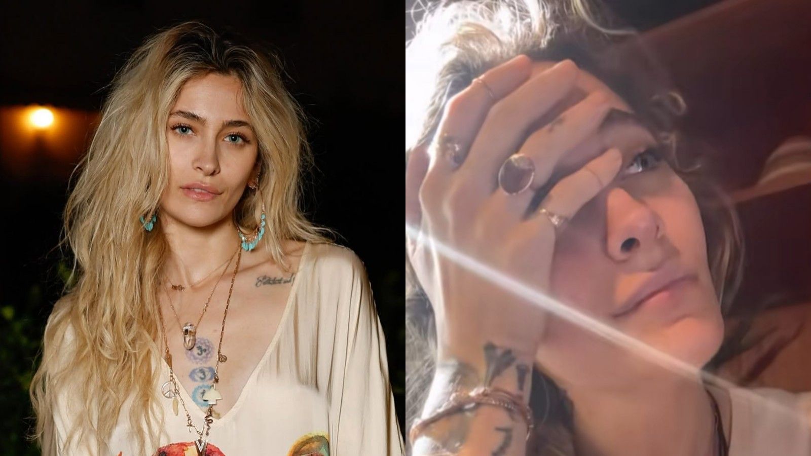 Paris Jackson impactó al mostrar las secuelas físicas de su adicción | 24horas