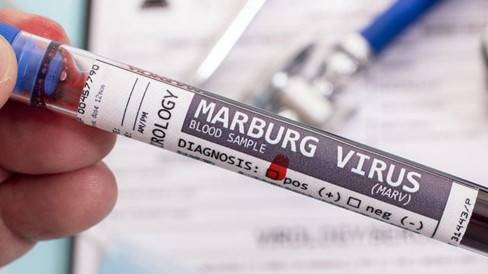 Marburgo virus en Etiopía