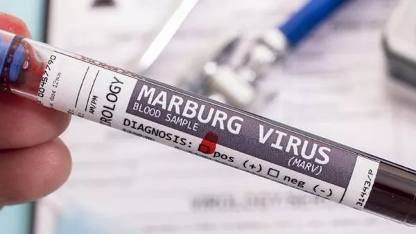 Marburgo virus en Etiopía