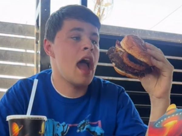 Joven de 17 años logró récord Guinness por el tamaño de su boca