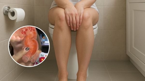 Doctora explica por qué los gases silenciosos huelen peor que los ruidosos