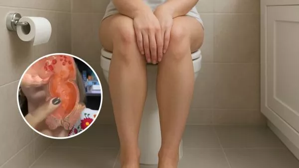 Doctora explica por qué los gases silenciosos huelen peor que los ruidosos